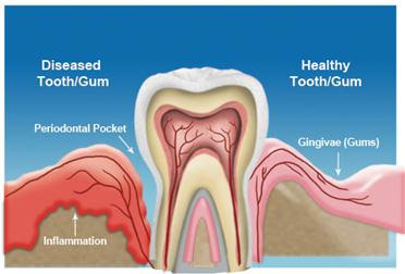 periodontics.jpg